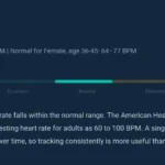 Resting Heart Rate Calculator results screen showing a Normal classification for 79 BPM with color-coded zone bar highlighting the Normal segment. The display includes age and sex comparison data showing normal range of 64-77 BPM for females aged 36-45, plus interpretive text about tracking trends over time.